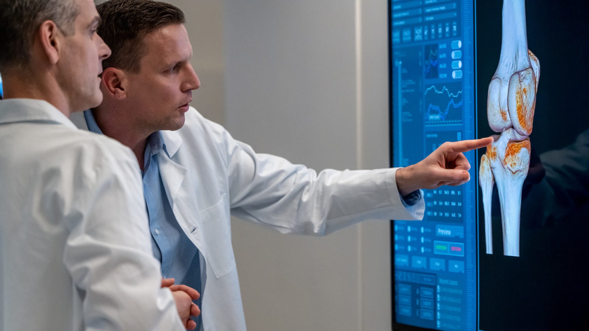 Why Fluid in Your Knee Causes Swelling Arthritis Knee Pain Centers