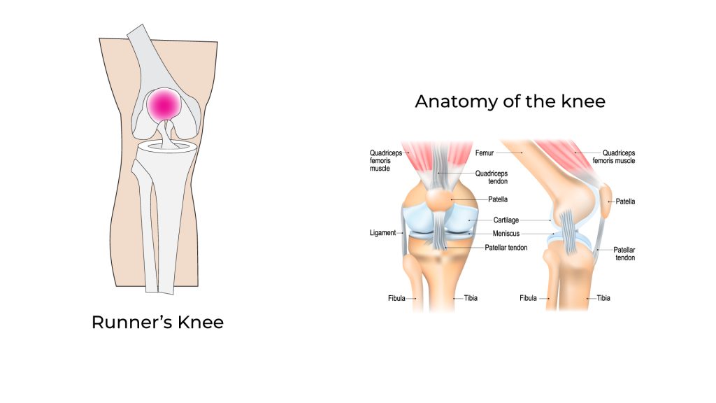 runners knee anatomy