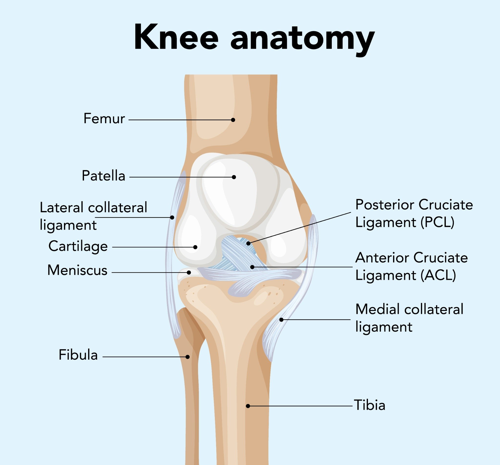 human knee joint with the femur at the top, the patella (kneecap) in front, the tibia and fibula at the bottom, along with the lateral collateral ligament (LCL) on the outer side, the medial collateral ligament (MCL) on the inner side, the lateral and medial menisci acting as shock absorbers, the anterior cruciate ligament (ACL) and posterior cruciate ligament (PCL) providing stability